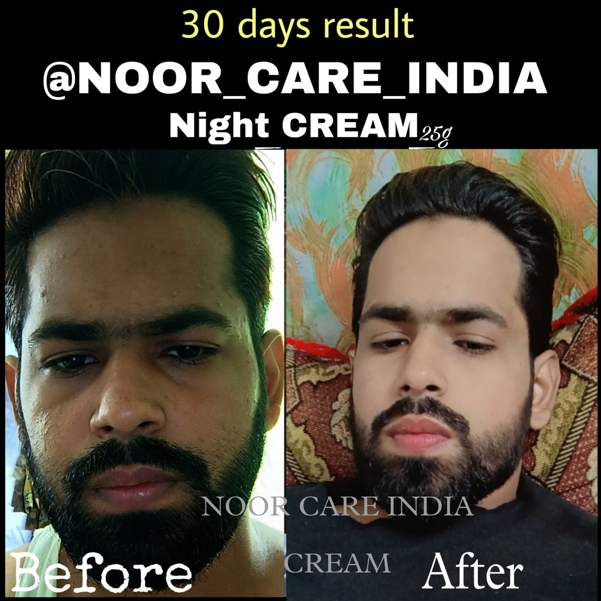 Noor Care Skin Whitening Combo | Ultra Whitening Night Cream & Goat Milk Rice Soap