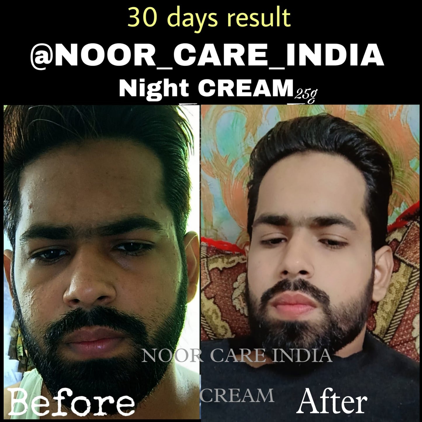 Noor Care Skin Whitening Combo | Ultra Whitening Night Cream & Goat Milk Rice Soap